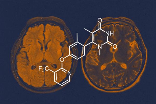 Brains with chemical diagram overlaid
