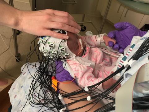 Dr. Puglia performs EEG on a baby in the Neonatal Intensive Care Unit for a study aimed at uncovering early biomarkers of autism.